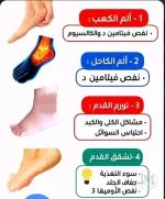 اسباب الم الرجل.webp