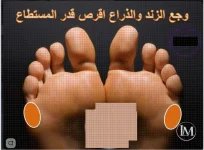 وجع الزند.webp