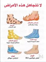 لا تتجاهل هذه الاعراض.webp