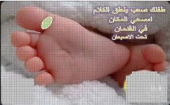 صعوبة النطق عند الاطفال.webp