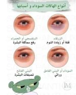 انواع الهالات.webp