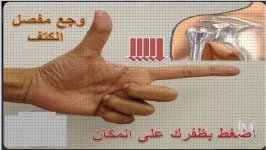 الم الكتف.webp