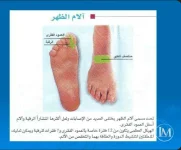 الام الظهر.webp