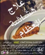 علاج هشاشة العظام.webp