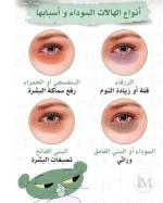 انواع الهالات.webp