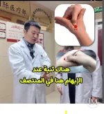 لعلاج الم الاسنان ومشاكل الوجه والحلق.webp