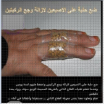 لالم الركبتين.PNG