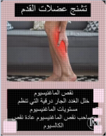 تشنج عضرت القدم.PNG