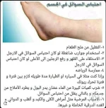 احتباس السوائل في الجسم.webp