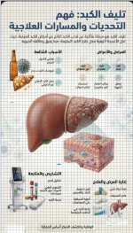 تليف الكبد.webp