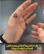 الهالات السوداء والعين.PNG