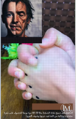 ازالة التجاعيد.PNG