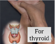 الغدة الدرقيه.PNG