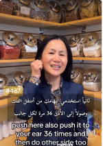 ترهلات الوجه2.PNG