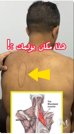 الابهر 1.PNG