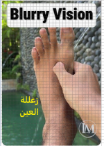 زغللة العين.PNG