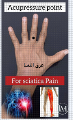 عرق النسا.PNG