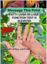 للكبد الدهني.PNG للكبد الدهني.PNG