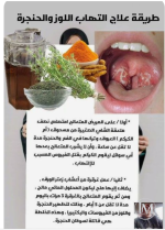 علاج التهاب اللوزه والحنجره.PNG