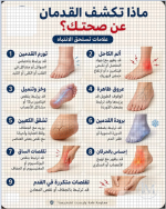 ماذا تكشف القدمان عن صحاك.PNG
