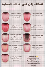 لسانك يدل على حالتك الصحيه.PNG لسانك يدل على حالتك الصحيه.PNG