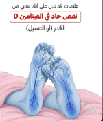 نقص فيتامين دال.PNG