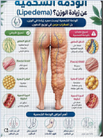 النذمه الشحميه.PNG