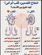 انتفاخ القدمين قلب ام كلى ؟؟