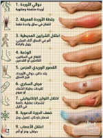 الام الرجل.PNG